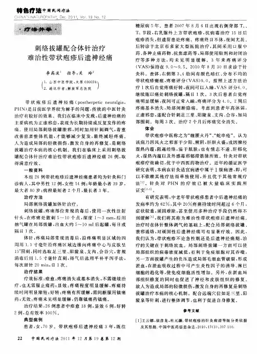 刺络拔罐配合体针治疗难治性带状疱疹后遗神经痛