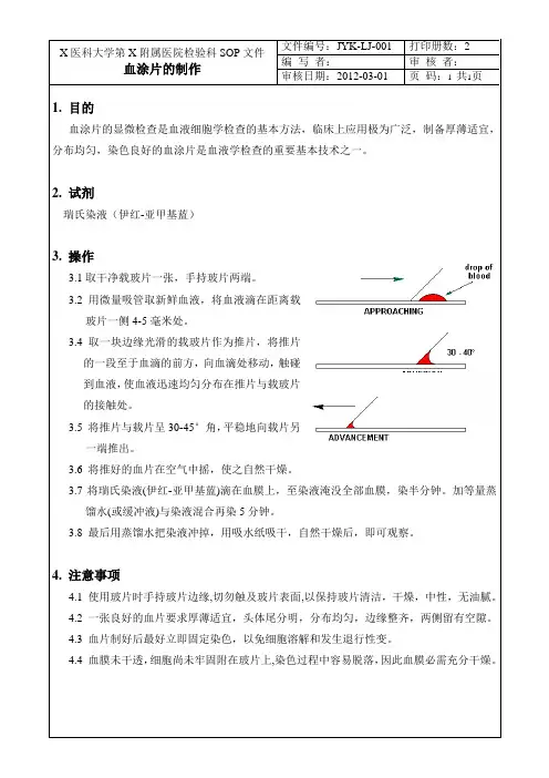 血涂片制作SOP