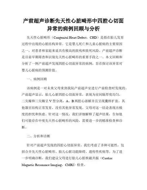 产前超声诊断先天性心脏畸形中四腔心切面异常的病例回顾与分析