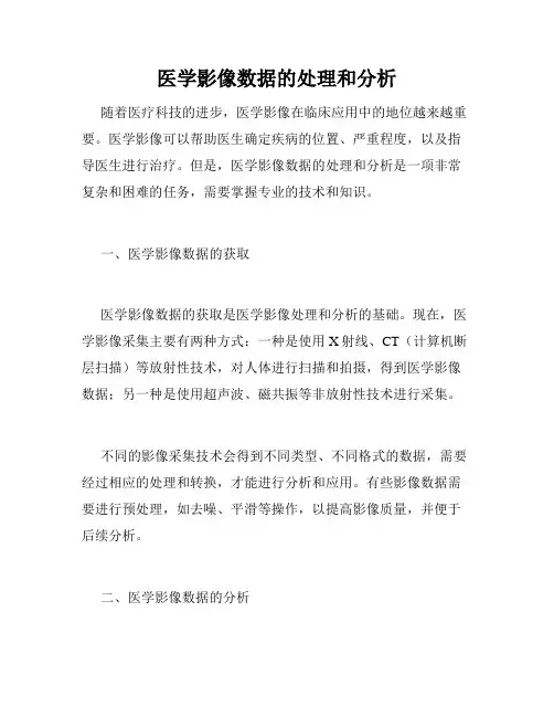 医学影像数据的处理和分析