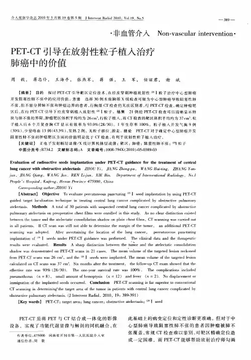 PET-CT引导在放射性粒子植入治疗肺癌中的价值
