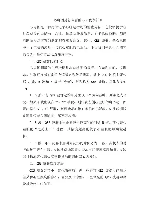 心电图是怎么看的qrs代表什么