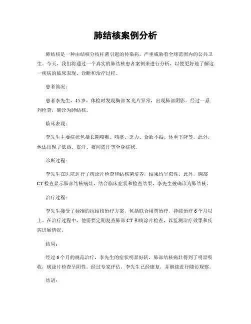 肺结核案例分析