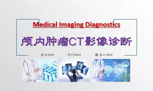 颅内肿瘤CT影像诊断