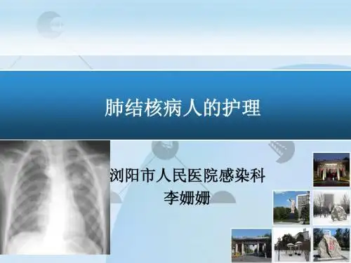 肺结核患者的护理