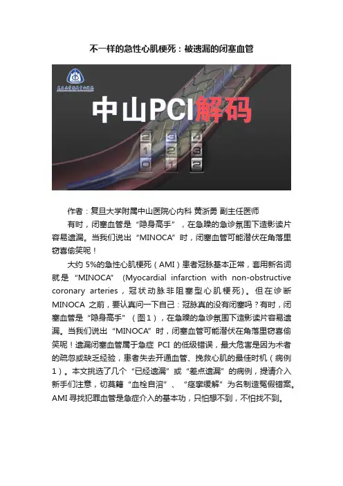 不一样的急性心肌梗死：被遗漏的闭塞血管
