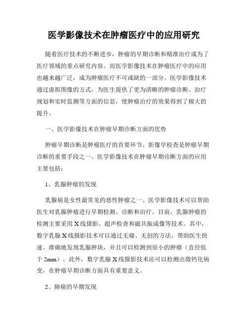 医学影像技术在肿瘤医疗中的应用研究