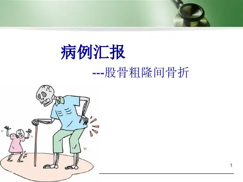 股骨粗隆间骨折病例汇报