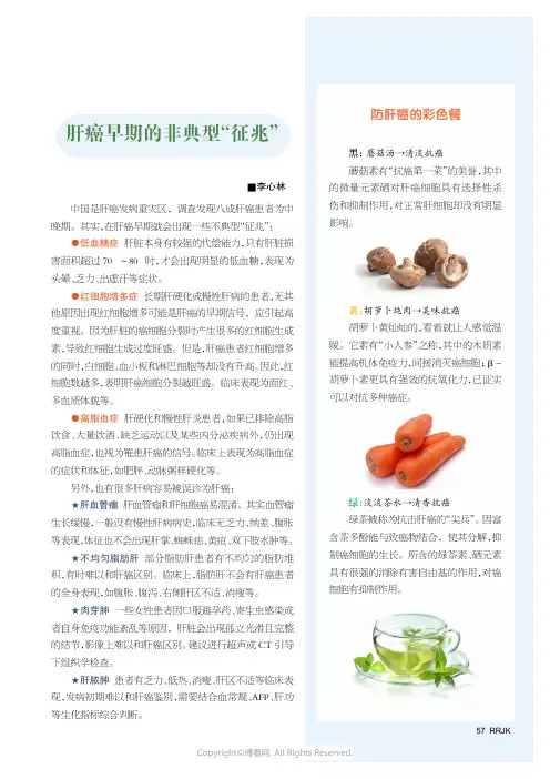 肝癌早期的非典型“征兆”