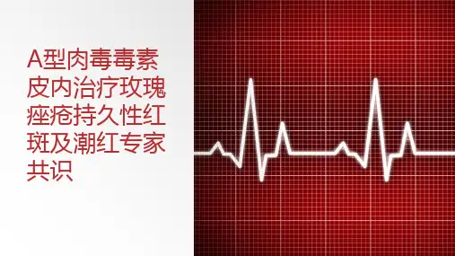 A型肉毒毒素皮内治疗玫瑰痤疮持久性红斑及潮红专家共识