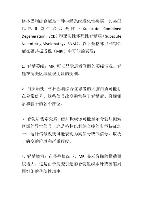 格林巴利综合症磁共振表现