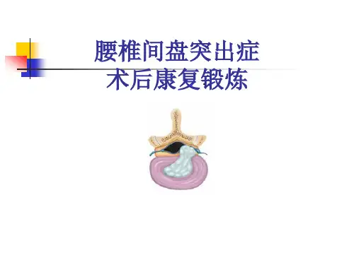 腰椎间盘突出症术后康复锻炼 PPT课件