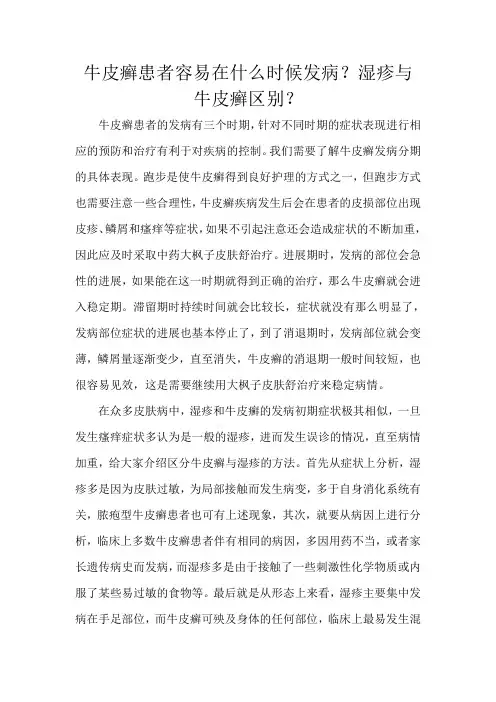牛皮癣患者容易在什么时候发病？湿疹与牛皮癣区别