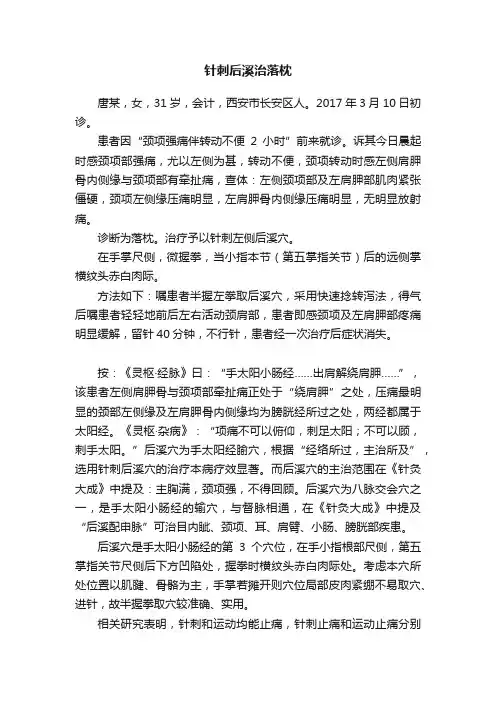 针刺后溪治落枕