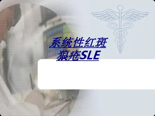 系统性红斑狼疮SLE讲义