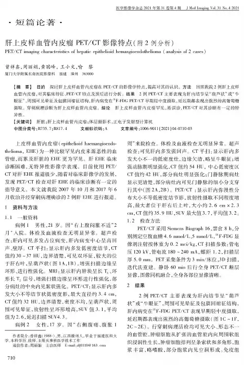 肝上皮样血管内皮瘤PETCT影像特点(附2例分析)