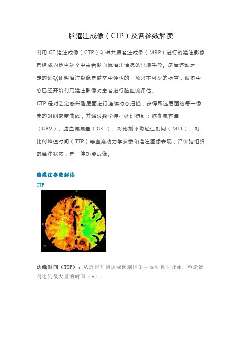 脑灌注成像(CTP)及各参数解读