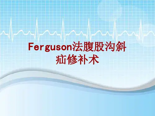 手术讲解模板：Ferguson法腹股沟斜疝修补术