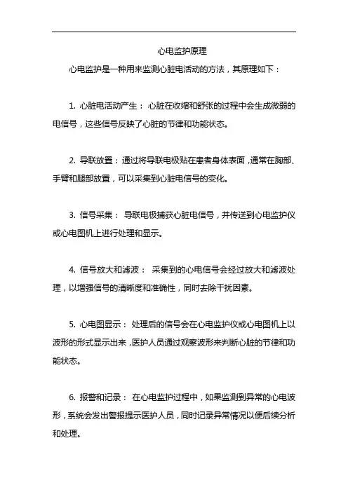 心电监护原理