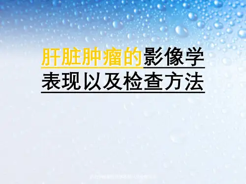 肝脏肿瘤影像学表现以及检查方法