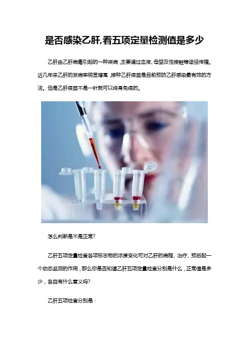 是否感染乙肝,看五项定量检测值是多少