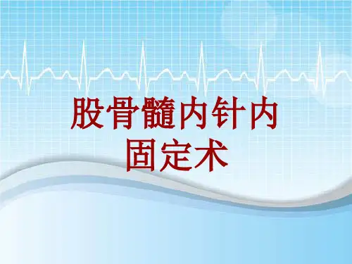 手术讲解模板：股骨髓内针内固定术