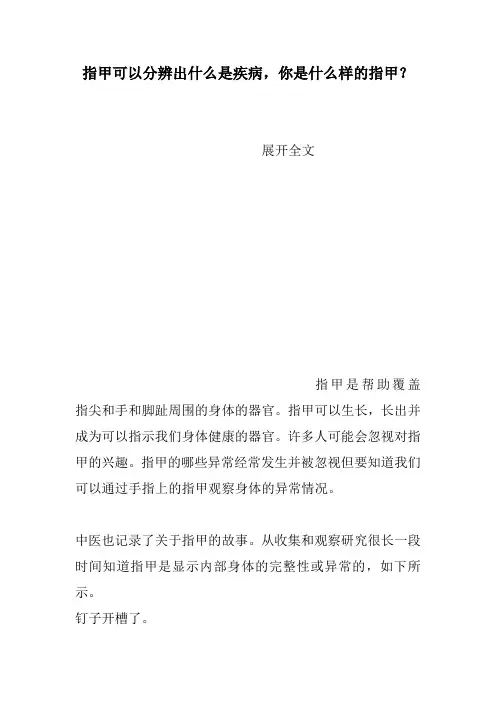 指甲可以分辨出什么是疾病,你是什么样的指甲？