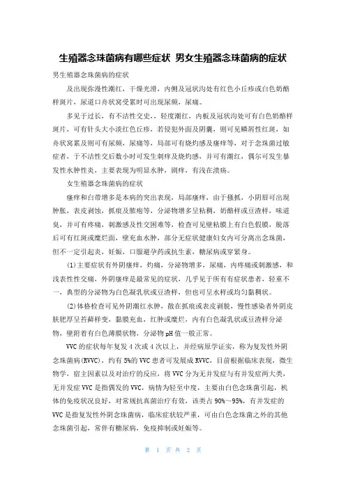 生殖器念珠菌病有哪些症状 男女生殖器念珠菌病的症状