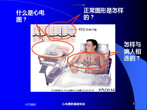 心电图的基础知识培训课件