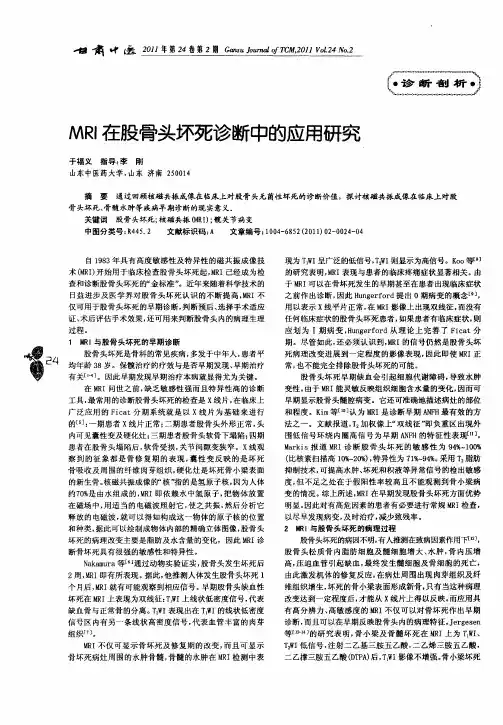 MRI在股骨头坏死诊断中的应用研究