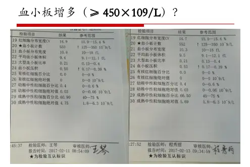 原发性血小板增多症诊断与治疗