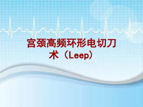 手术讲解模板：宫颈高频环形电切刀术(Leep)