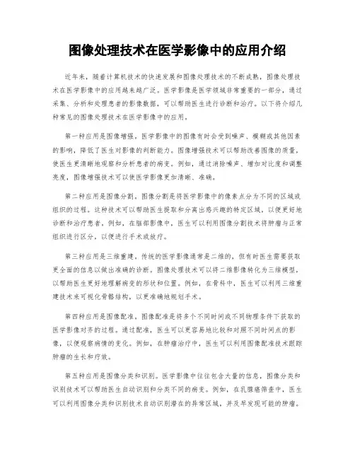 图像处理技术在医学影像中的应用介绍