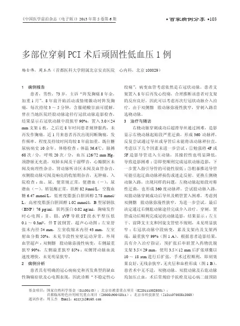 多部位穿刺PCI术后顽固性低血压1例
