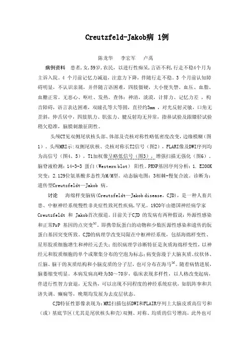 【2017年整理】克雅氏病一例