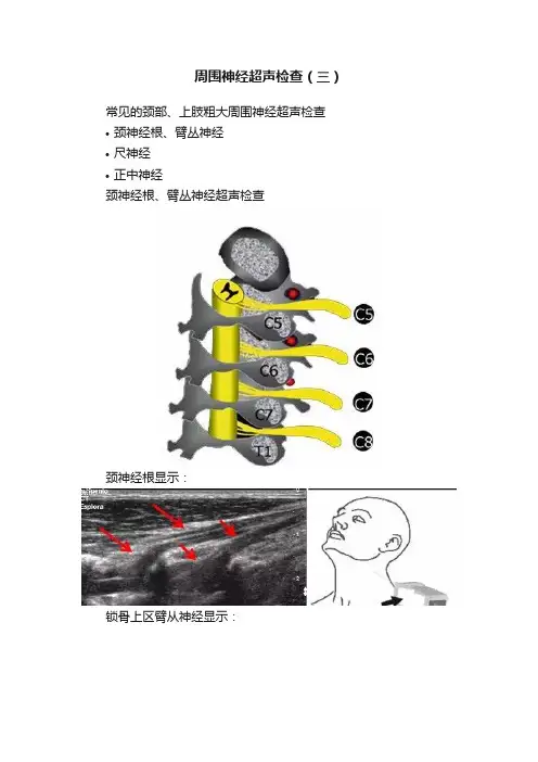 周围神经超声检查（三）