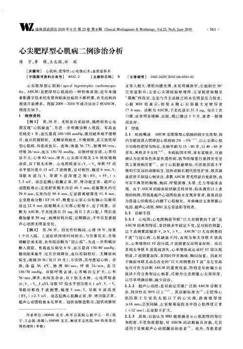 心尖肥厚型心肌病二例诊治分析
