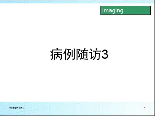 神经纤维瘤病 (1)