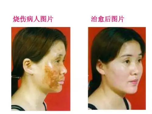 动物细胞工程