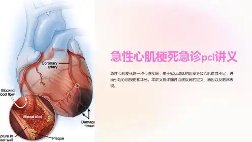 急性心肌梗死急诊pci讲义