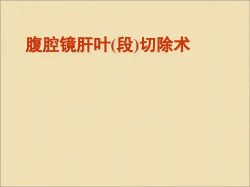 腹腔镜肝切除ppt课件