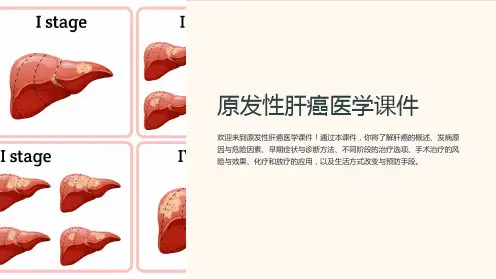 原发性肝癌医学课件