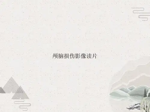 颅脑损伤影像读片