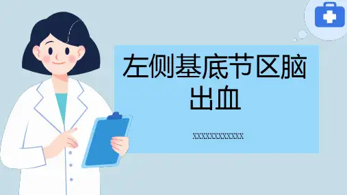 左侧基底节区脑出血