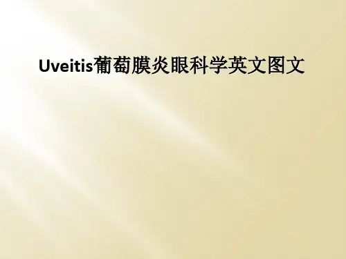 Uveitis葡萄膜炎眼科学英文图文