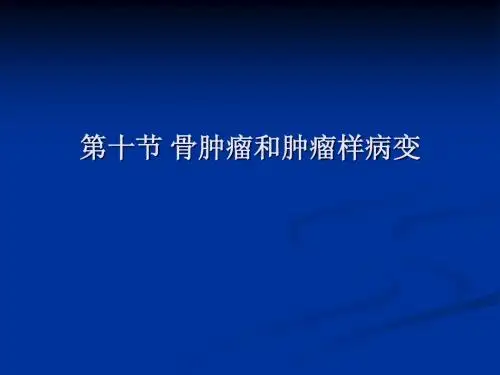 5.骨肿瘤