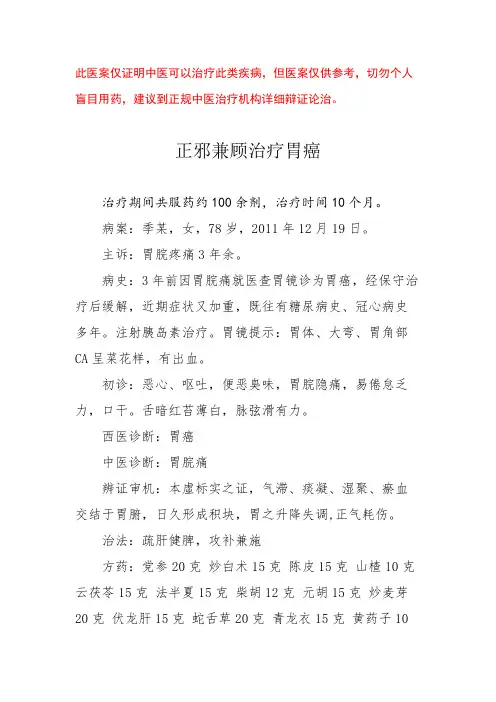 中医医案——胃癌
