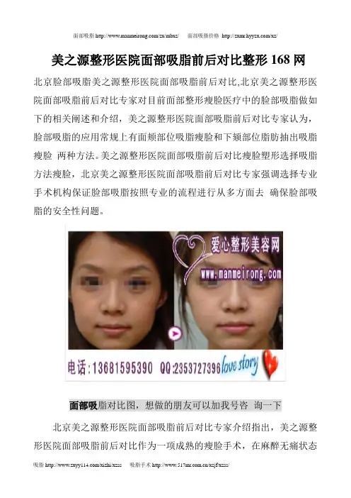 美之源整形医院面部吸脂前后对比整形168网