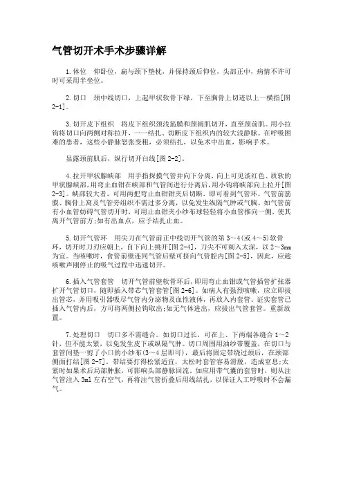 (完整word版)气管切开术手术步骤详解