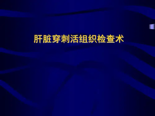 肝脏穿刺活组织检查术